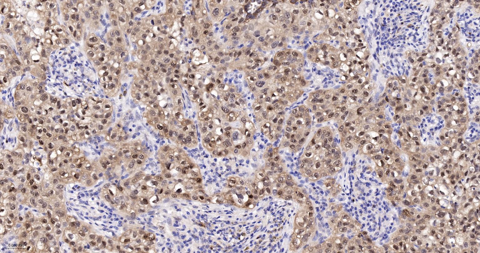 Rabbit anti-HSP70 Monoclonal Antibody