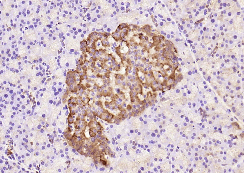Rabbit anti-Phospho-IRS1(Tyr632) Polyclonal Antibody