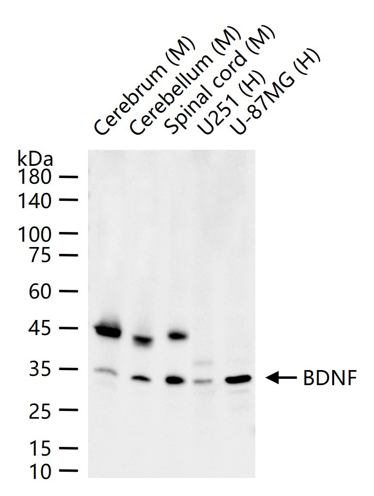 Rabbit anti- BDNF Monoclonal Antibody