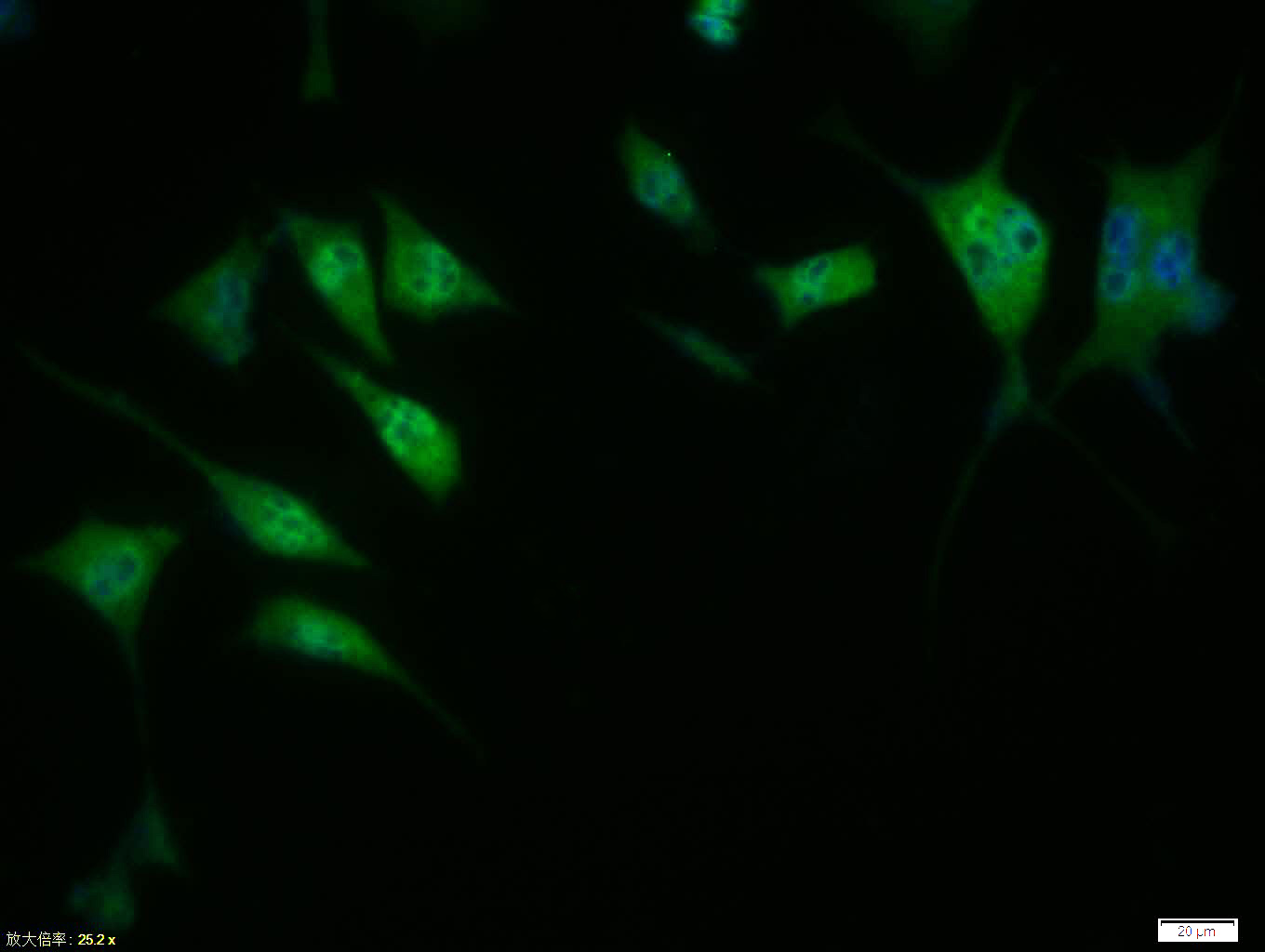 Rabbit anti-Phospho-Cyclin D1(Thr286) Polyclonal Antibody