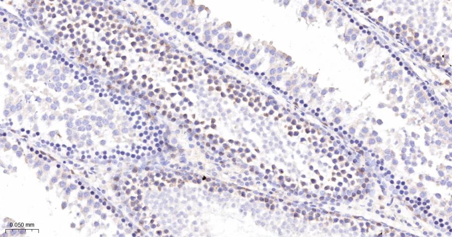 Rabbit anti-PKC δ Monoclonal Antibody