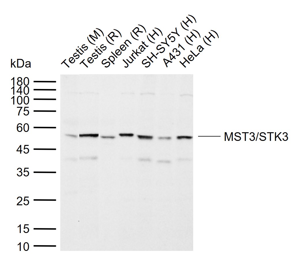 Rabbit Anti-STK3+STK4 Polyclonal Antibody