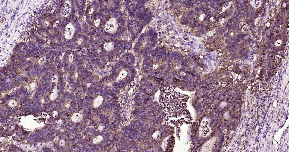 Rabbit anti-Galectin 3 Polyclonal Antibody