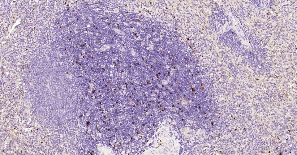 Mouse anti-S100B Monoclonal Antibody