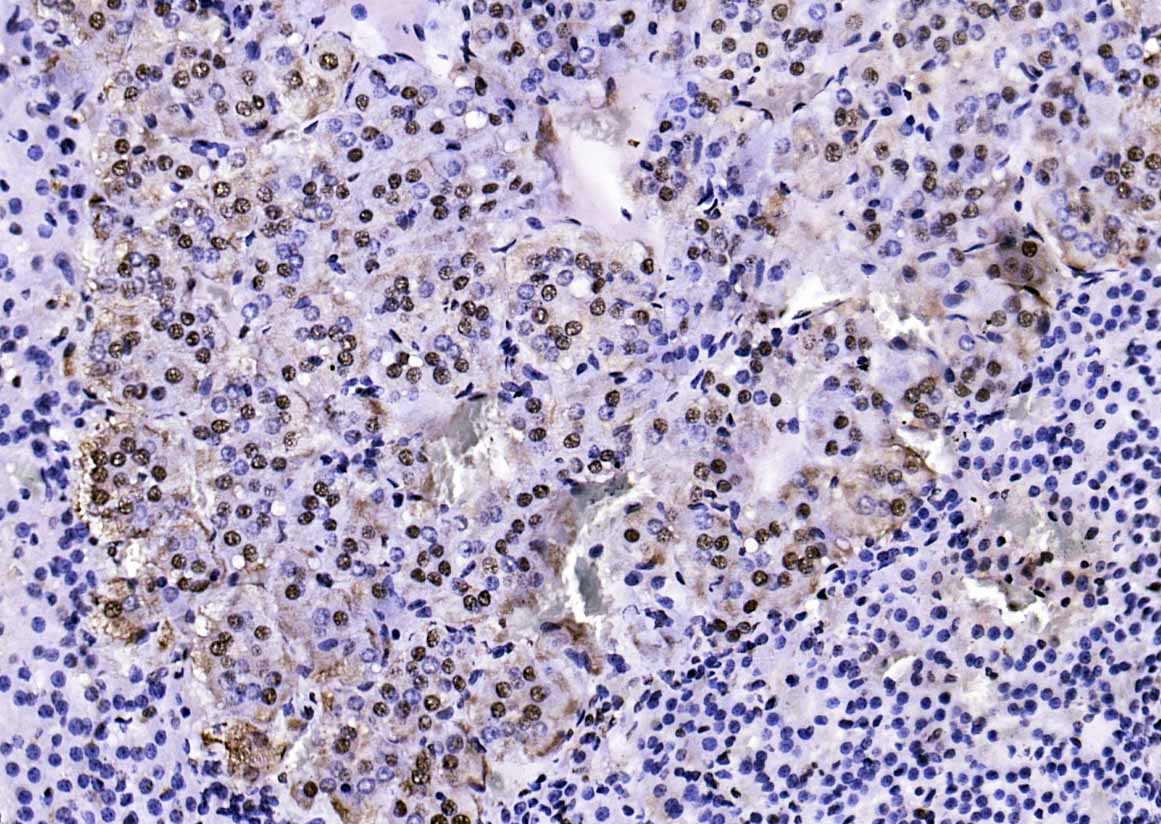 Rabbit anti-Phospho-PTEN(Ser380+Thr382+Thr383) Polyclonal Antibody