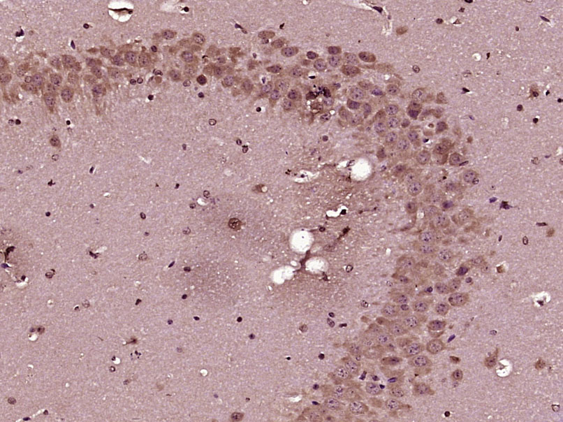 Rabbit anti-MCFD2 Polyclonal Antibody