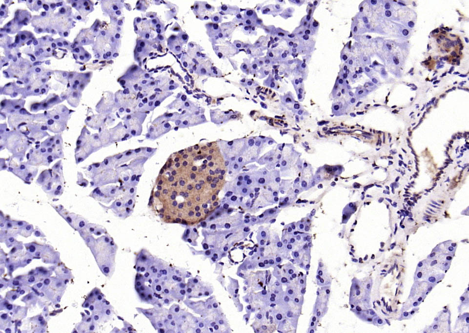 Rabbit anti-SOD2 Polyclonal Antibody
