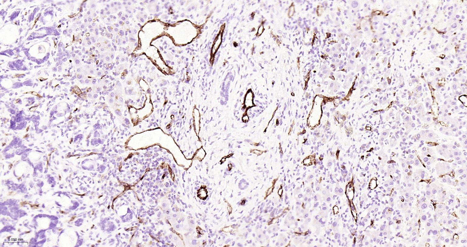 Mouse anti-CD31 Monoclonal Antibody
