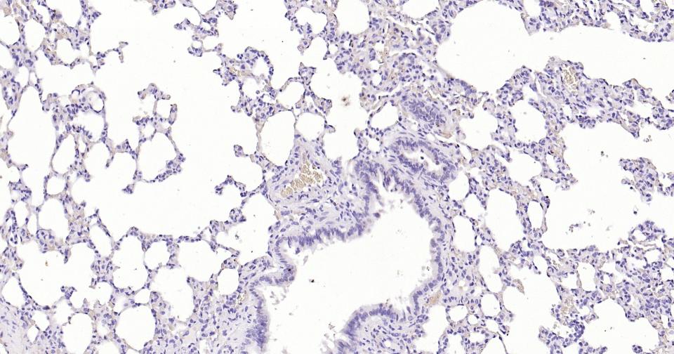 Mouse anti-S100B Monoclonal Antibody