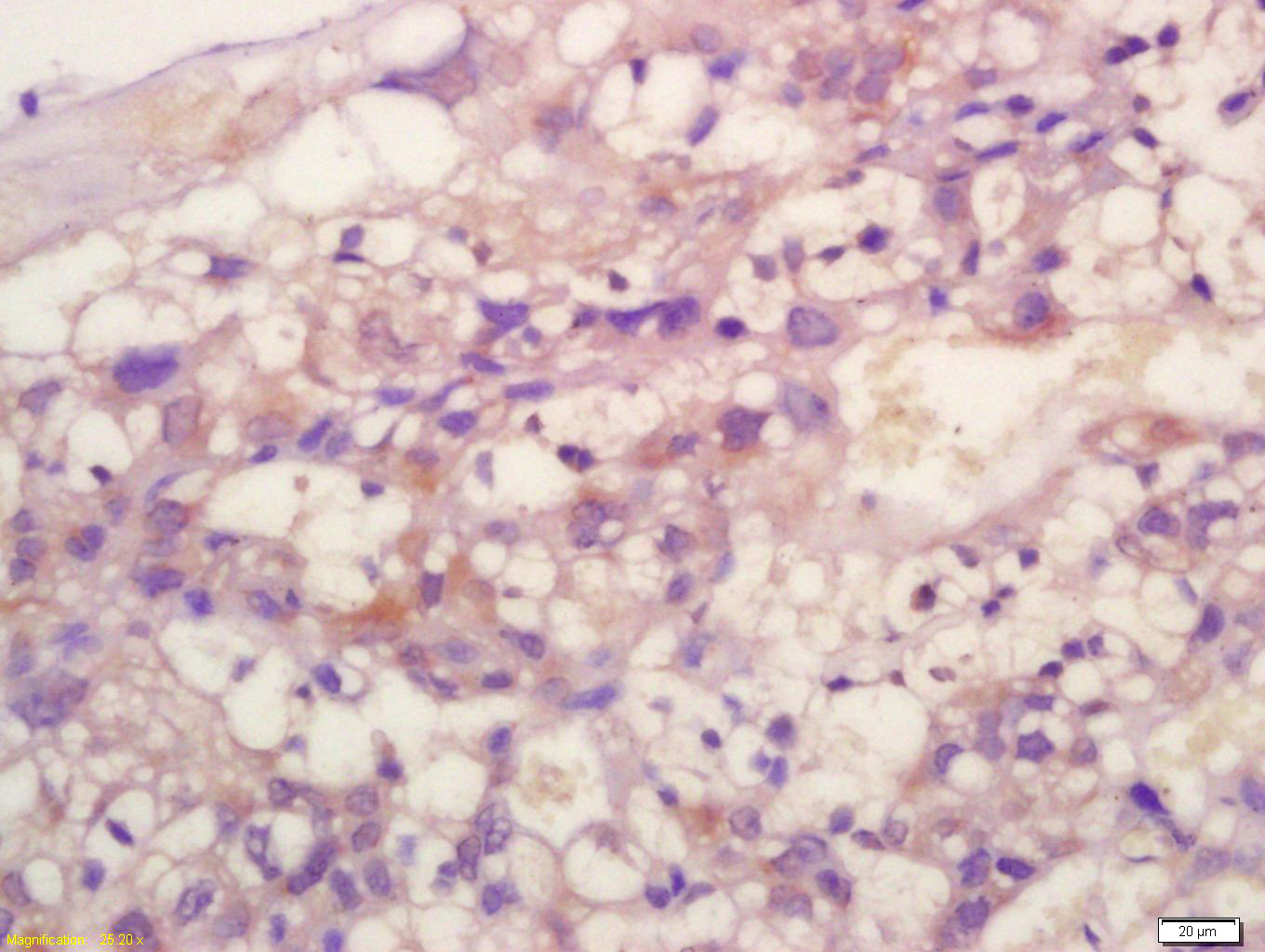 Rabbit anti-TIMP-2 Polyclonal Antibody