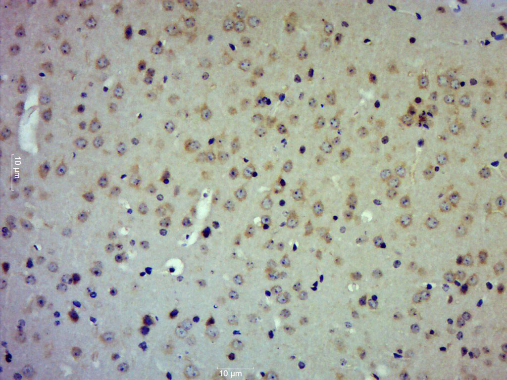 Rabbit anti-TIMP-2 Polyclonal Antibody