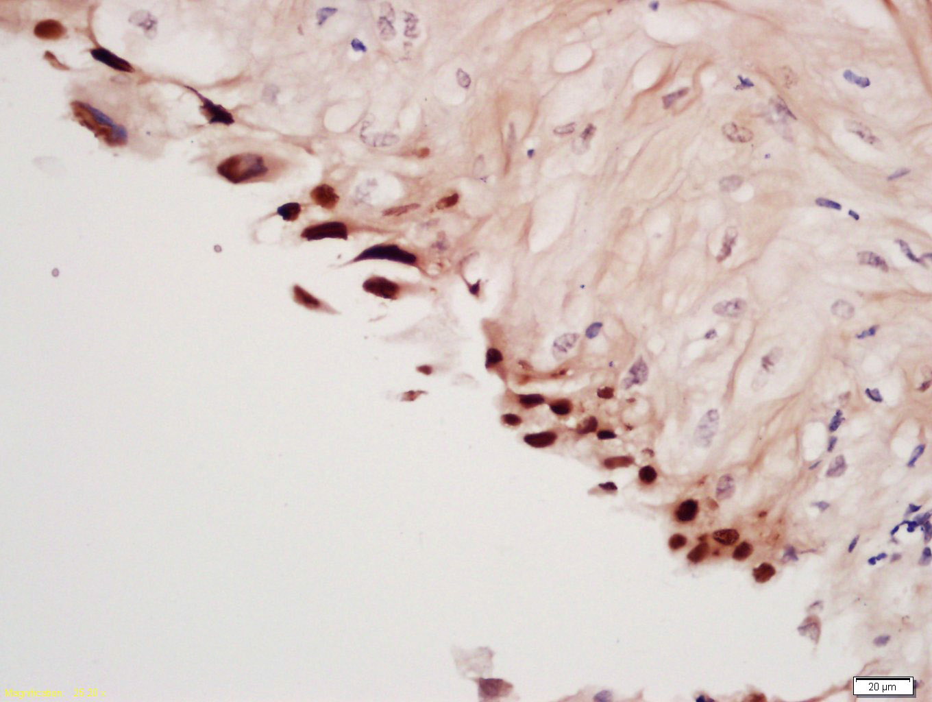 Rabbit Anti-Spindlin 1 Polyclonal Antibody
