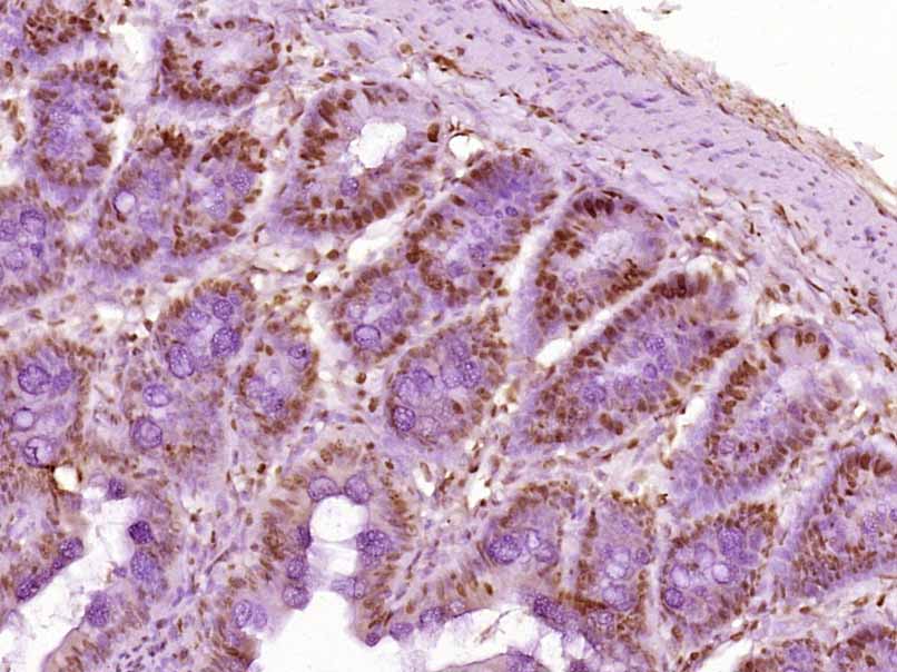 Rabbit anti-Histone H3(Acetyl K23) Polyclonal Antibody