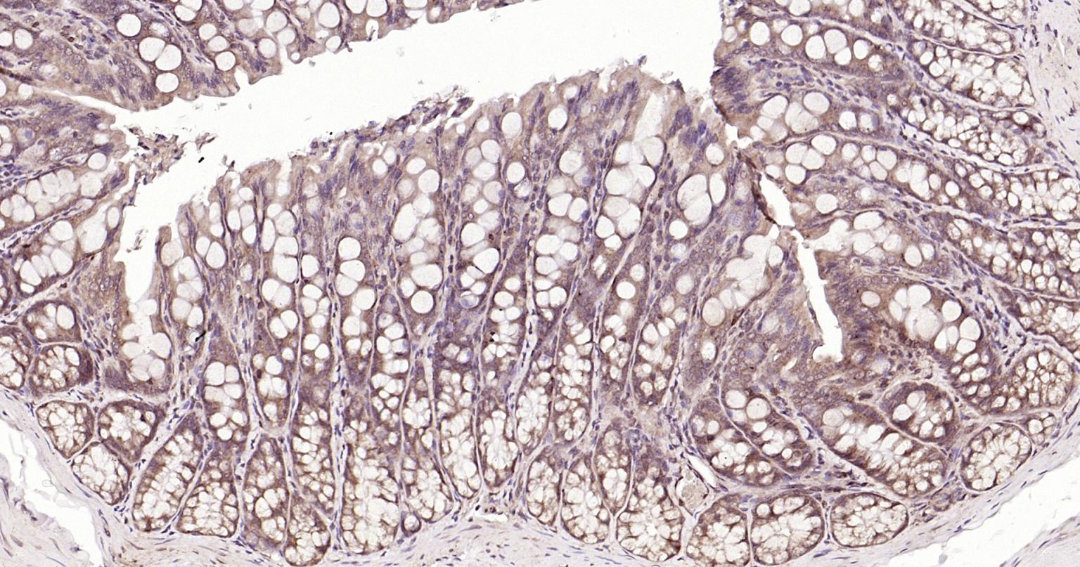 Rabbit anti-Beclin 1 Polyclonal Antibody