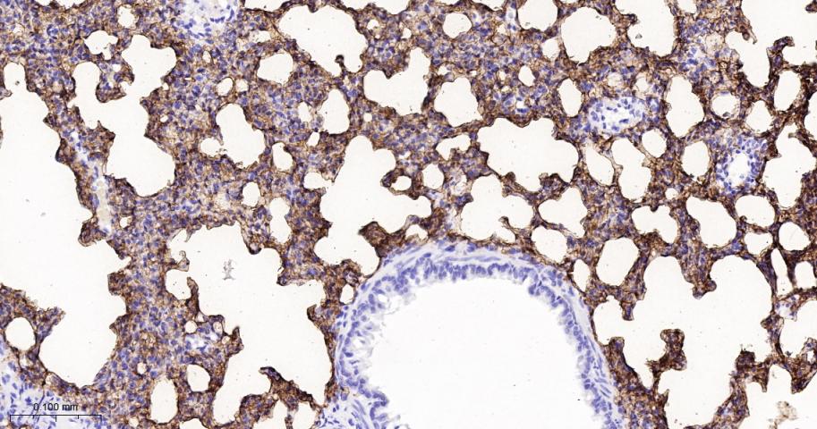 Rabbit anti-RAGE Monoclonal Antibody