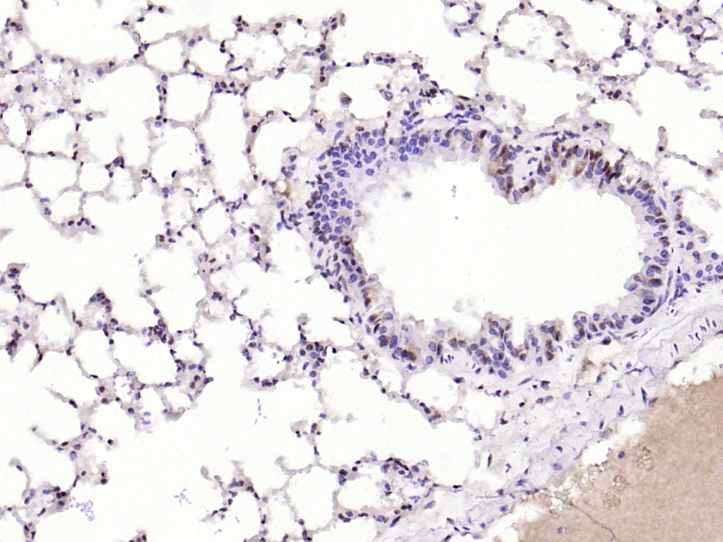 Rabbit anti-Phospho-YB1(Ser102) Polyclonal Antibody