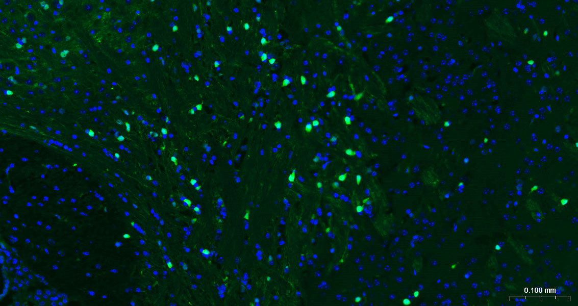 Mouse anti-S100B Monoclonal Antibody