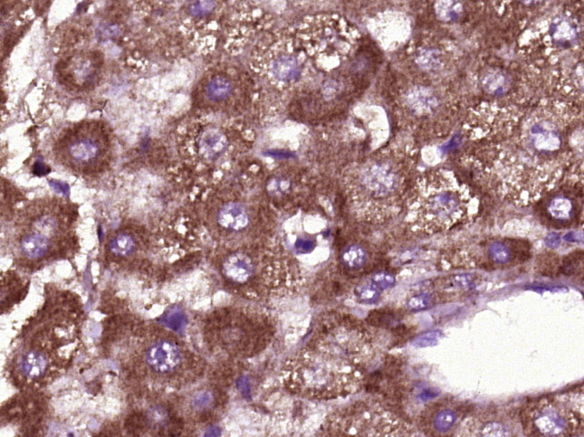 Rabbit Anti-BTBD17 Polyclonal Antibody