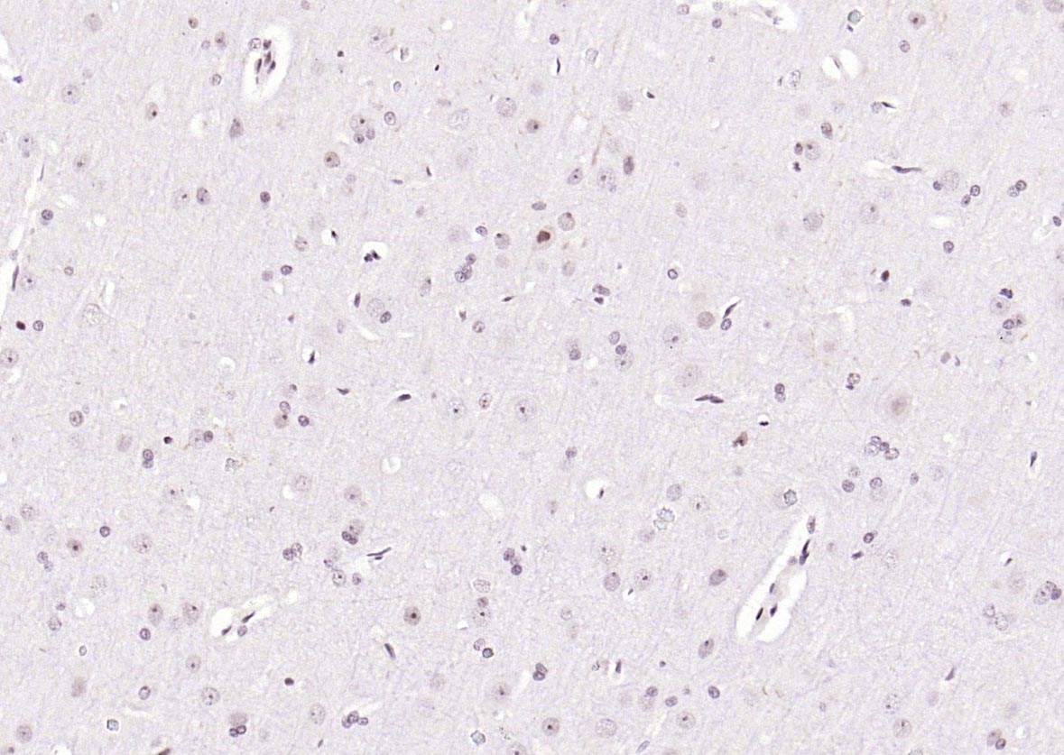 Rabbit anti-Phospho-PTEN(Ser380+Thr382+Thr383) Polyclonal Antibody