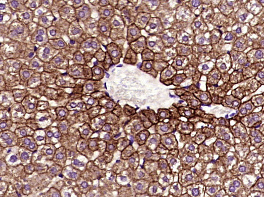 Mouse anti-Cytokeratin 8 Monoclonal Antibody