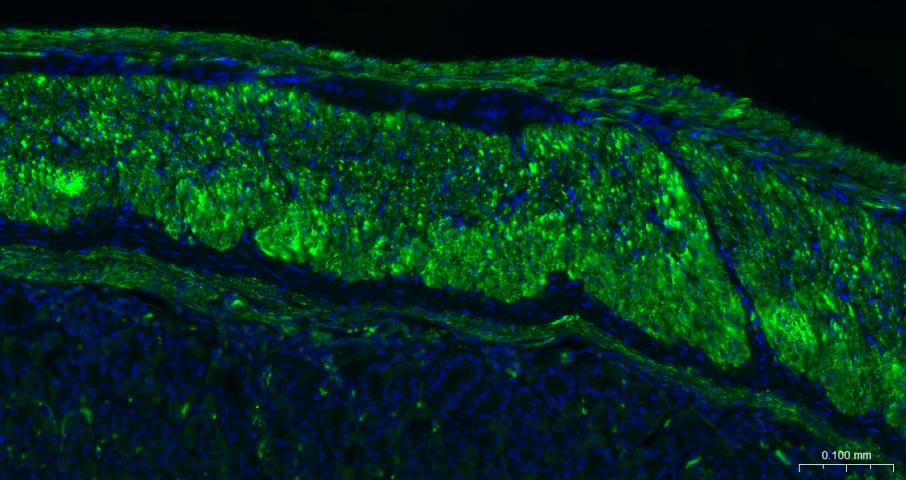 Rabbit anti-α Smooth Muscle Actin Monoclonal Antibody