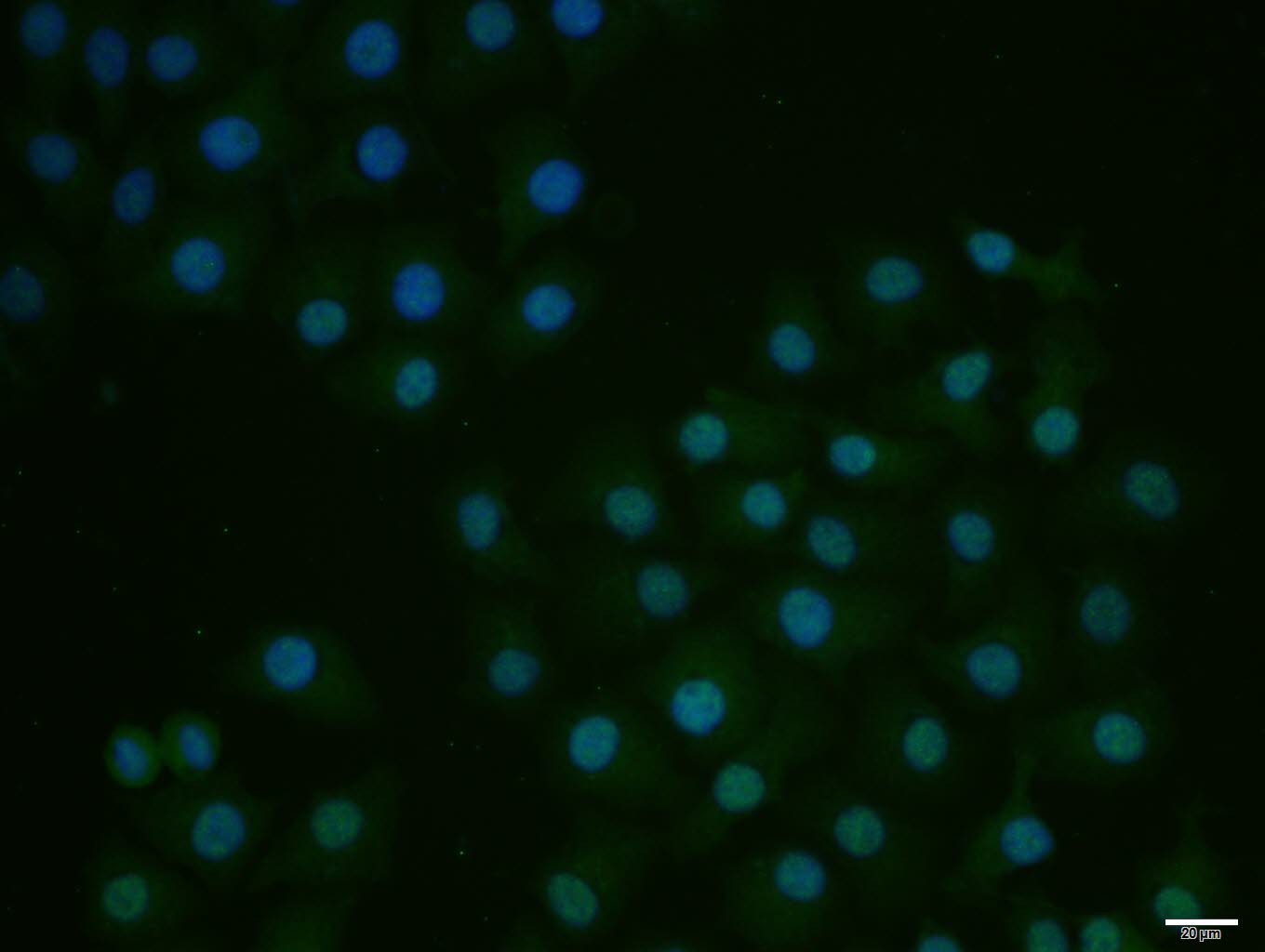 Rabbit anti-E2F1 Polyclonal Antibody
