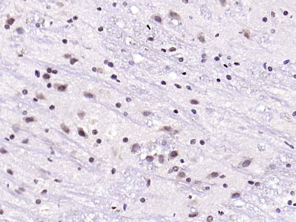 Rabbit anti-Phospho-IRS1(Ser636+Ser639) Polyclonal Antibody