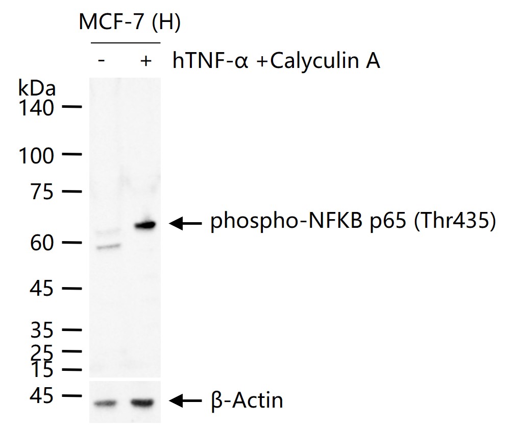 Rabbit anti-Phospho-NFKB p65(Thr435) Polyclonal Antibody