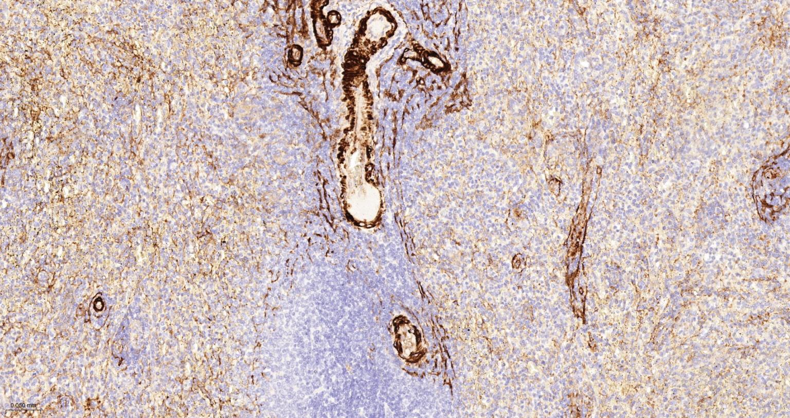 Rabbit anti-CD105 Polyclonal Antibody