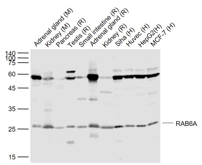 Rabbit anti-RAB6A Polyclonal Antibody