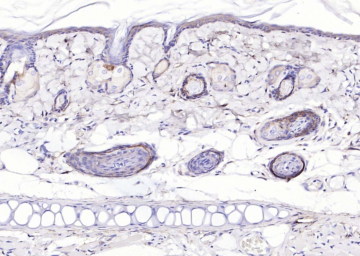 Rabbit anti-EGFR Polyclonal Antibody
