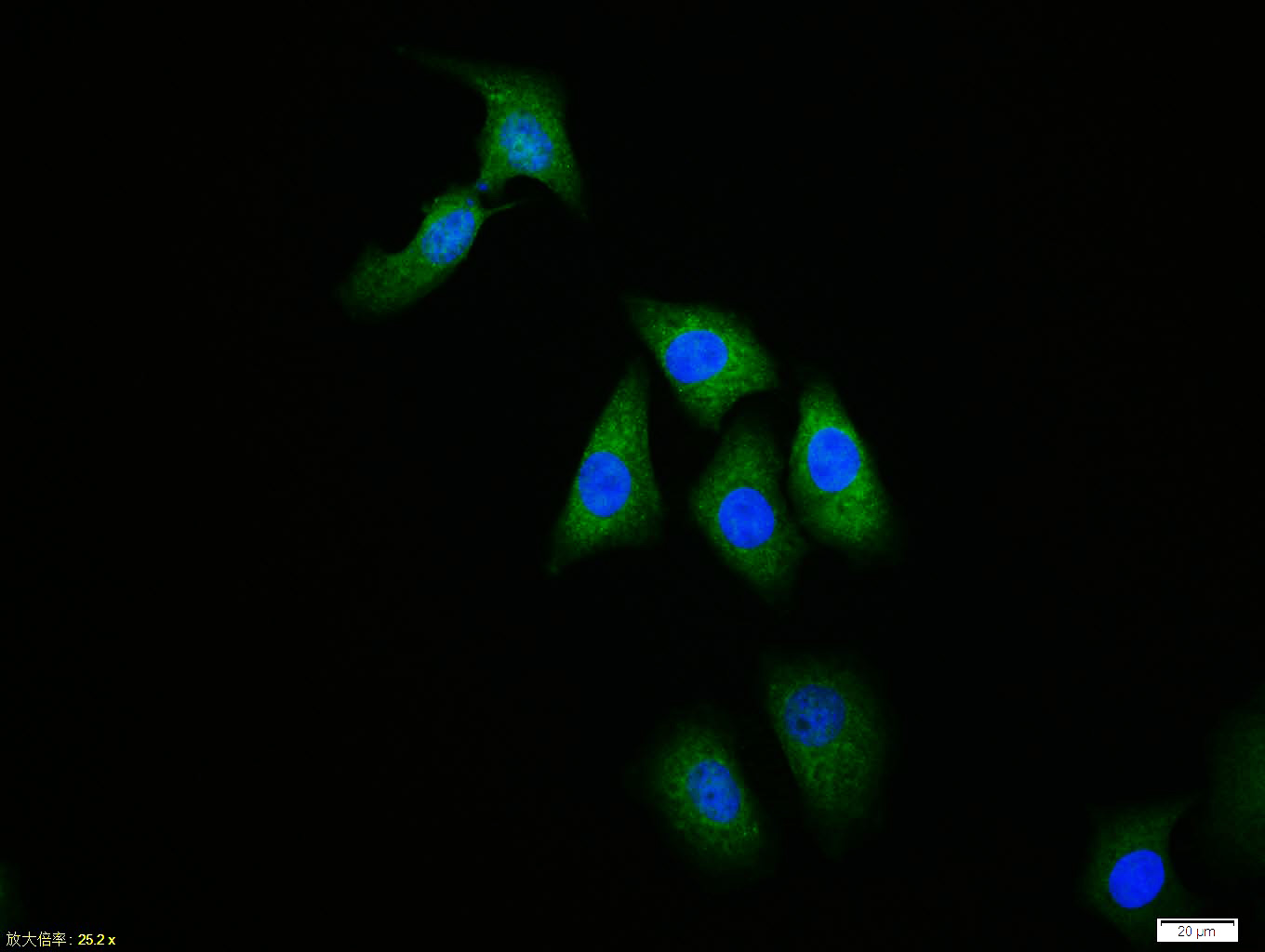 Rabbit anti-Ubiquitin Polyclonal Antibody