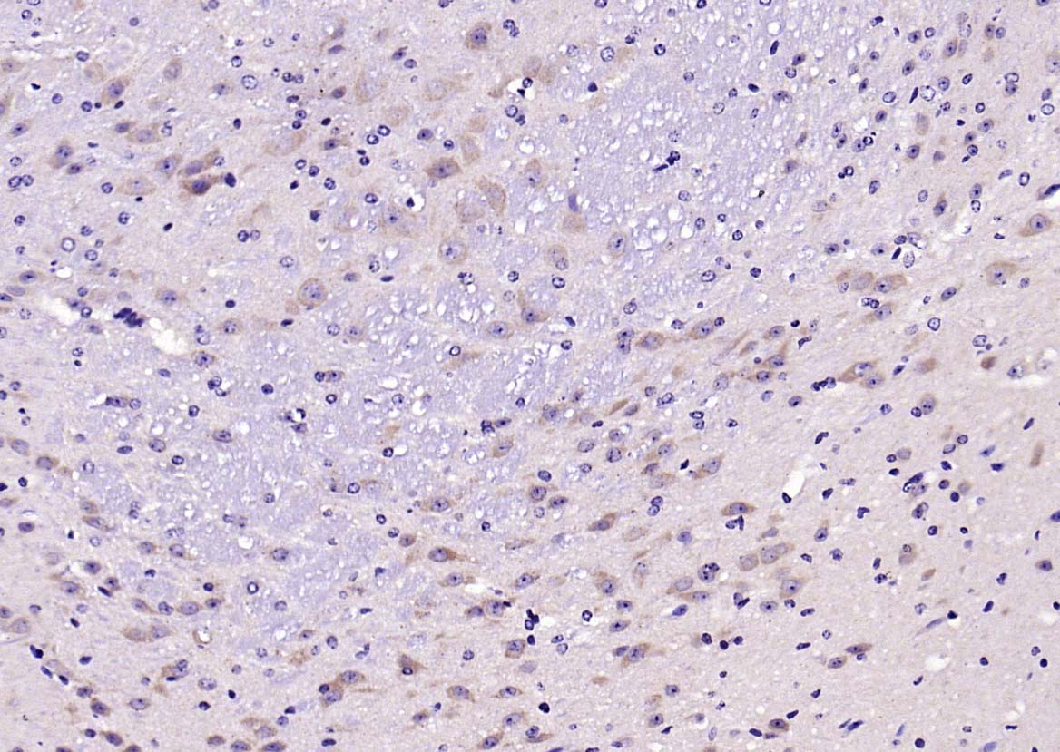 Rabbit anti-SOD2 Polyclonal Antibody