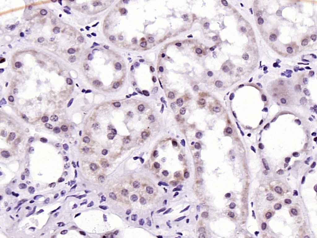 Rabbit anti-ATM Monoclonal Antibody