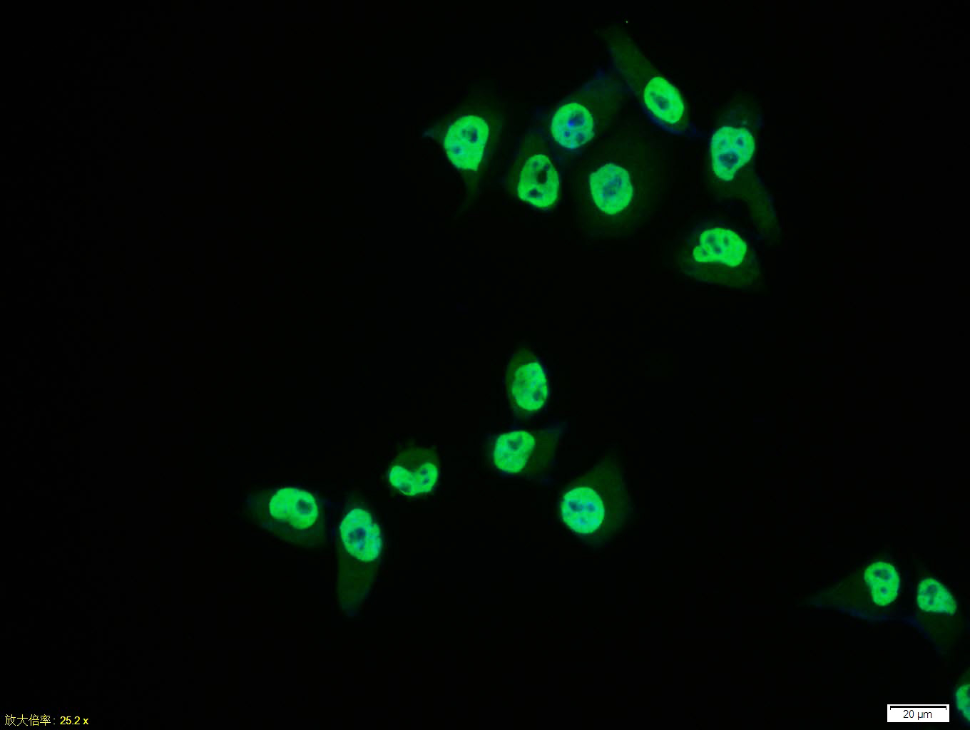 Rabbit anti-Phospho-PTEN(Ser380+Thr382+Thr383) Polyclonal Antibody