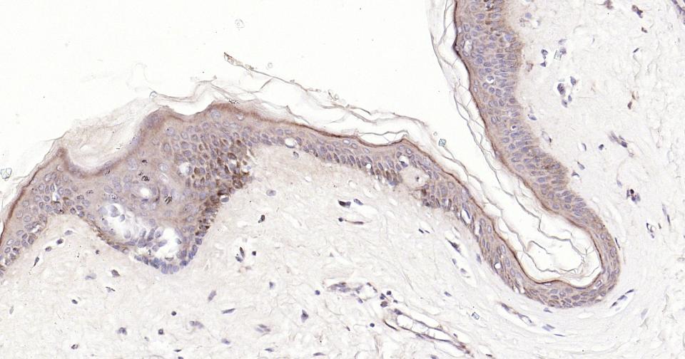 Rabbit anti-Bax Monoclonal Antibody