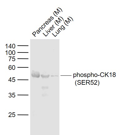Rabbit anti-Phospho-CK18(Ser52) Polyclonal Antibody