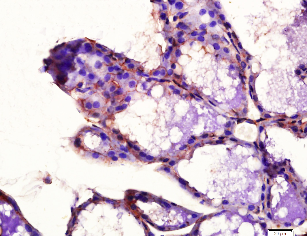Rabbit anti-Phospho-PDGFRA(Tyr754) Polyclonal Antibody