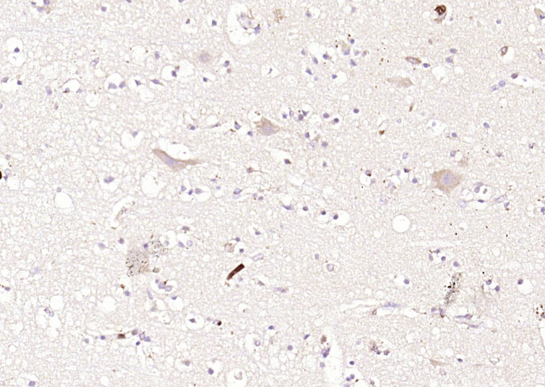 Rabbit Anti-MARCH6 Polyclonal Antibody