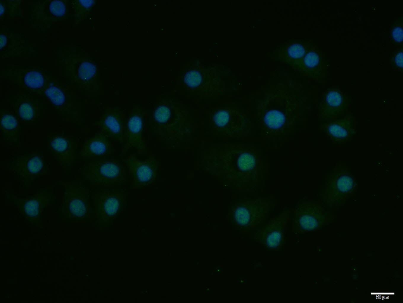 Rabbit anti-E2F1 Polyclonal Antibody