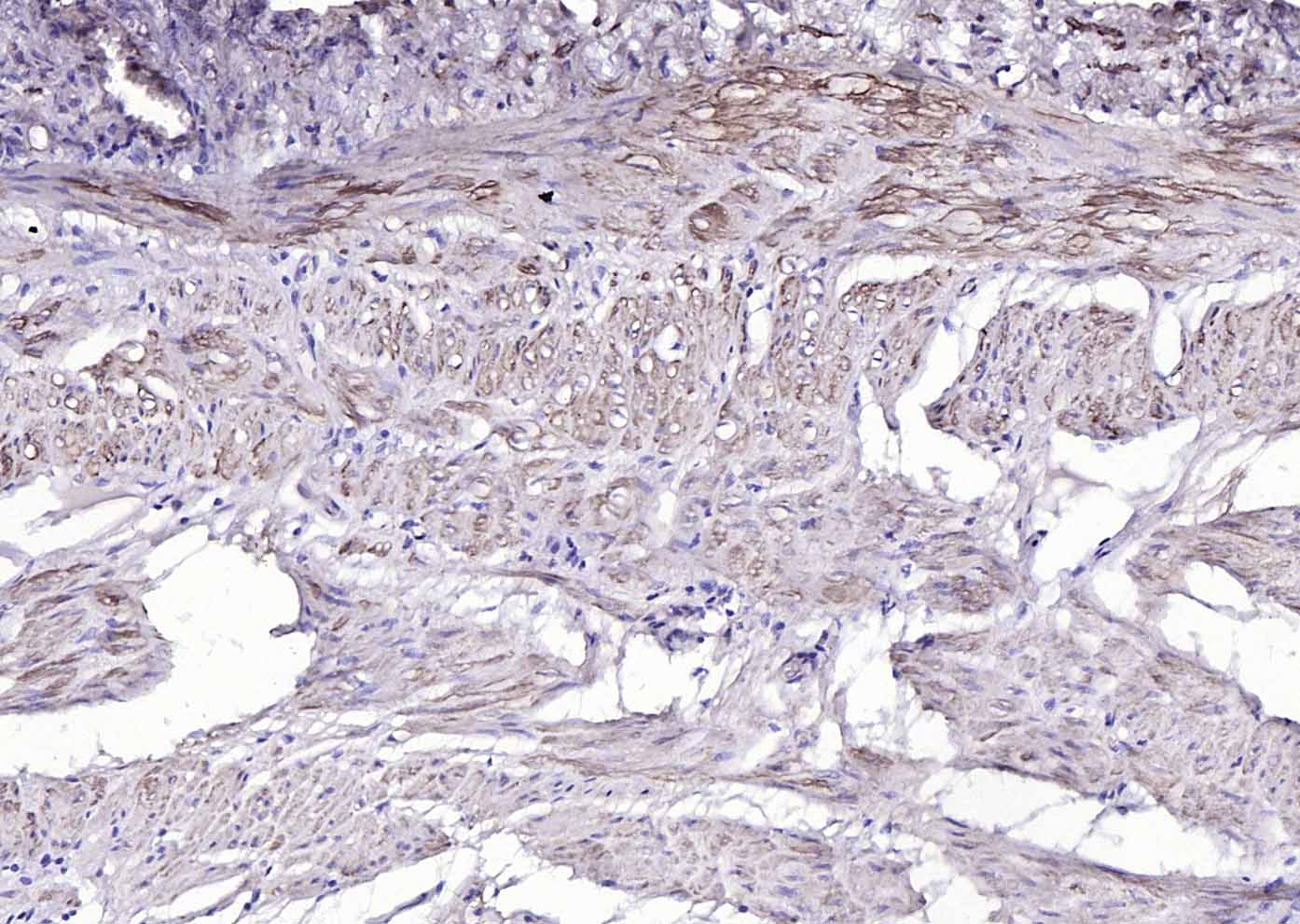 Rabbit anti-α Smooth Muscle Actin Polyclonal Antibody