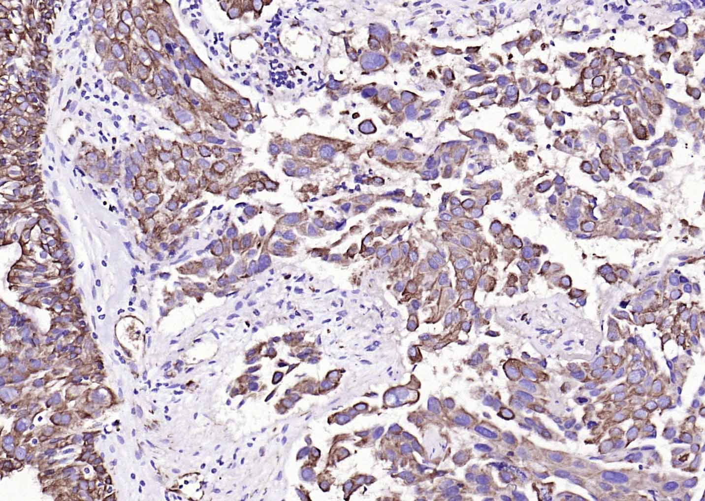 Mouse anti-Cytokeratin 19 Monoclonal Antibody