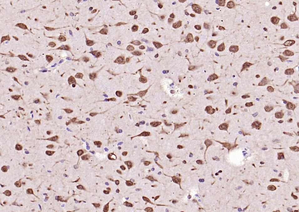 Rabbit anti-Phospho-ERK1(Thr202/Tyr204)+ERK2(Thr183/Tyr185) Polyclonal Antibody
