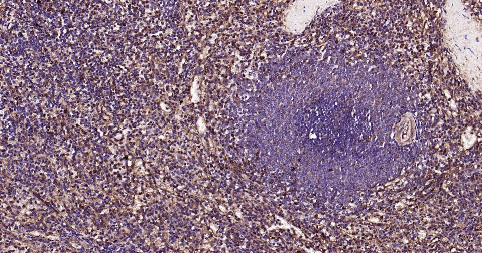 Rabbit anti-Galectin 3 Polyclonal Antibody
