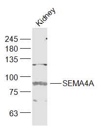 Rabbit Anti-SEMA4A Polyclonal Antibody