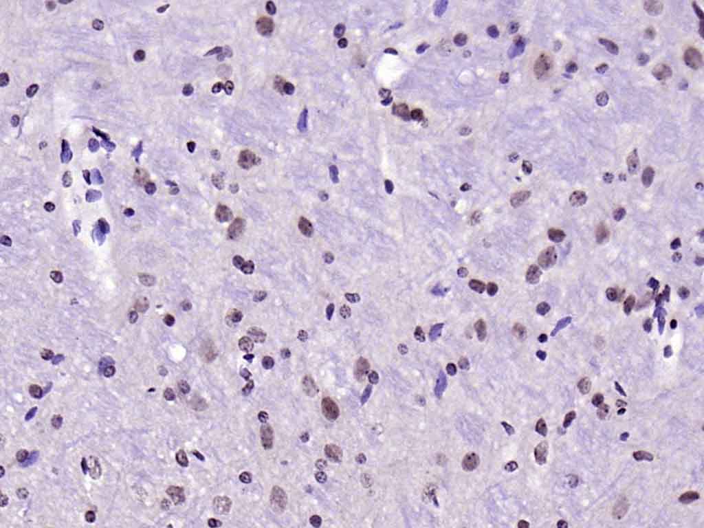 Rabbit anti-Phospho-IRS1(Ser636+Ser639) Polyclonal Antibody