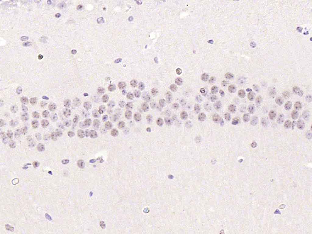 Rabbit anti-Phospho-Smad2(Ser467) Polyclonal Antibody