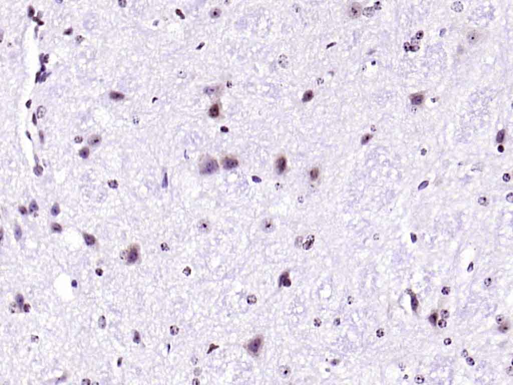 Rabbit anti-Phospho-IRS1(Ser636+Ser639) Polyclonal Antibody