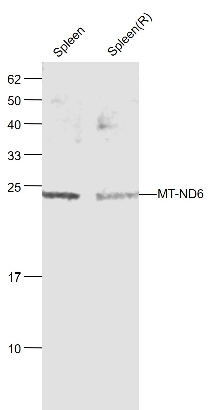 Rabbit anti-MT-ND6 Polyclonal Antibody