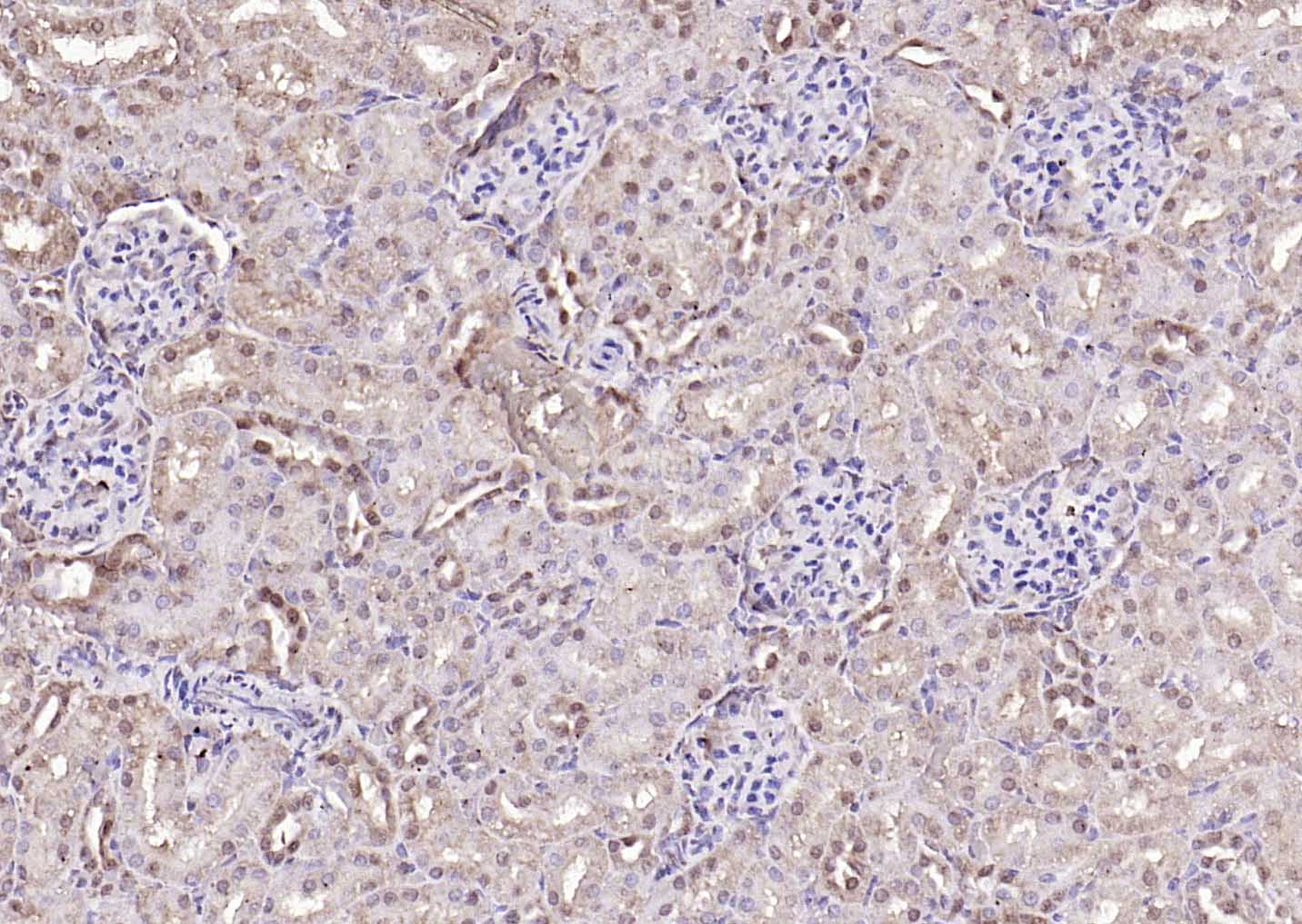 Rabbit anti-Proteasome 20S α1 Polyclonal Antibody